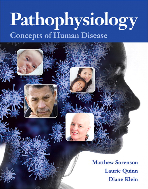 Picture of Pathophysiology
