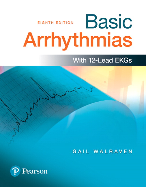 Picture of Basic Arrhythmias